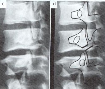 collies vs. smith fracture collies vs. smith fracture